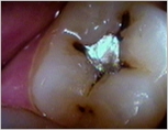 Caroline Dental